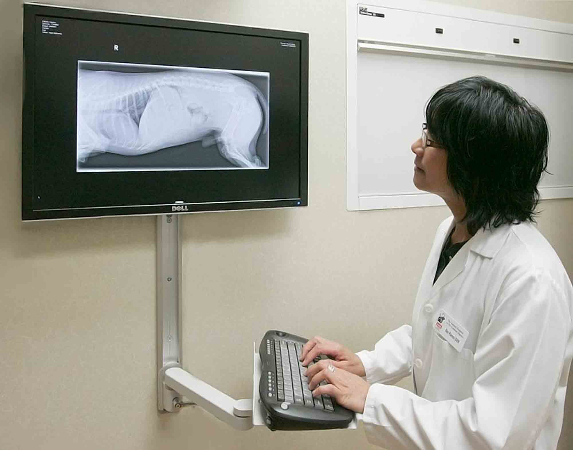 Digital x-ray system
